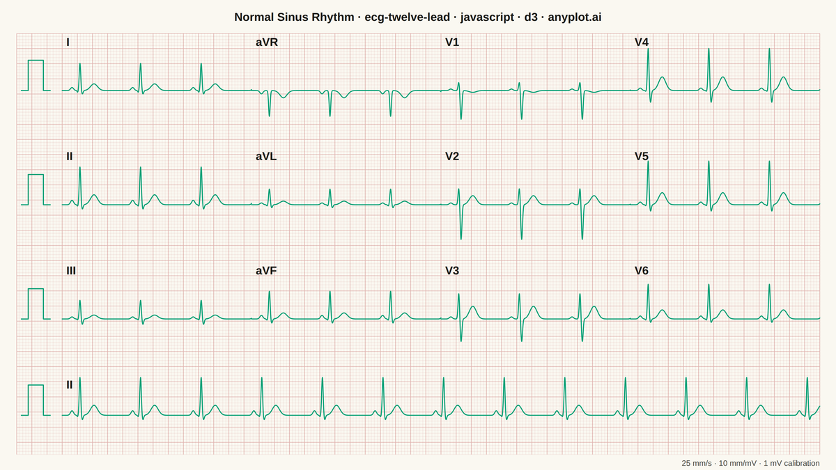 ECG/EKG 12-Lead Waveform Display rendered with D3.js
