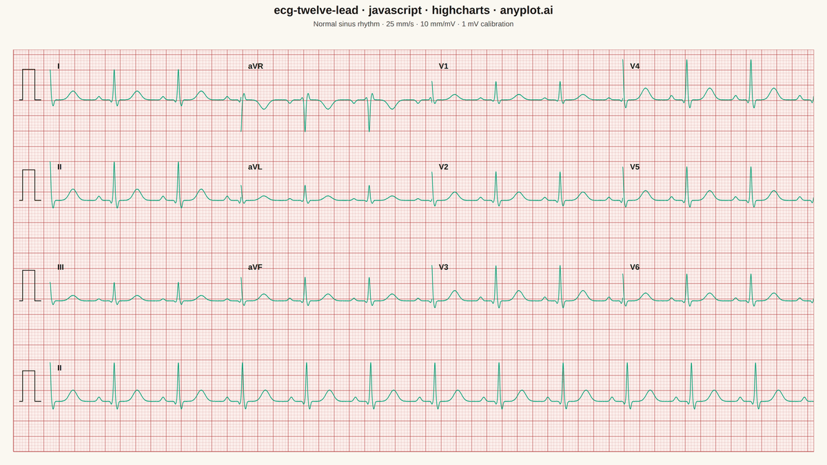 ECG/EKG 12-Lead Waveform Display rendered with Highcharts