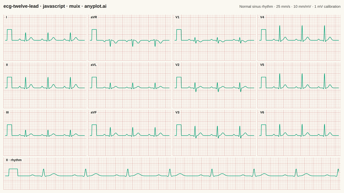 ECG/EKG 12-Lead Waveform Display rendered with MUI X Charts