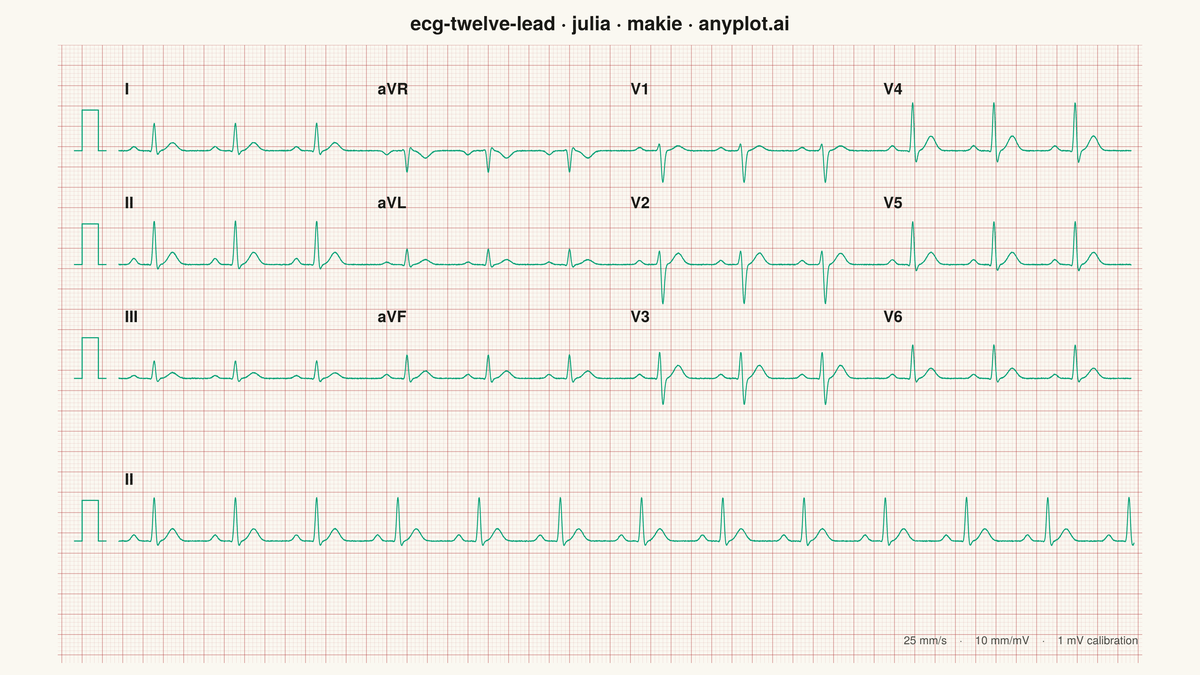 ECG/EKG 12-Lead Waveform Display rendered with Makie.jl