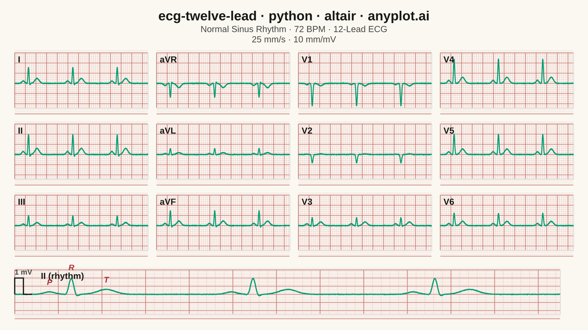ECG/EKG 12-Lead Waveform Display