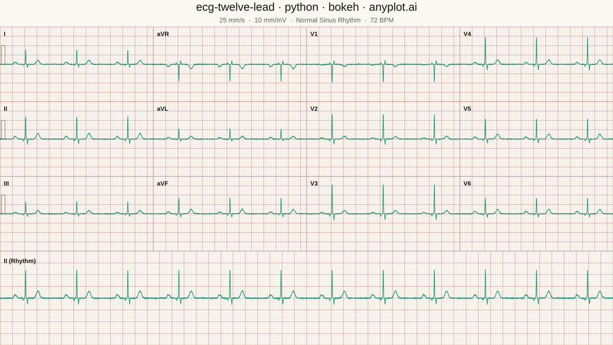 ECG/EKG 12-Lead Waveform Display rendered with Bokeh