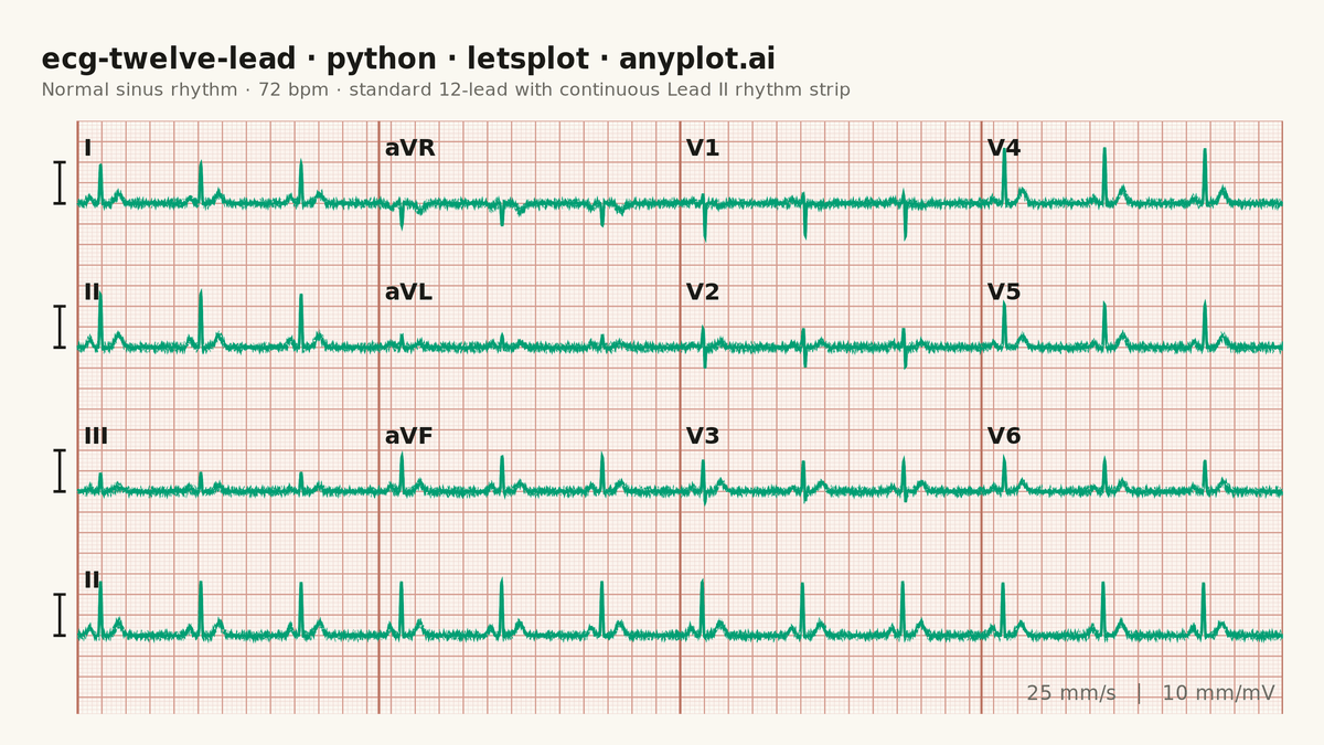 ECG/EKG 12-Lead Waveform Display rendered with lets-plot