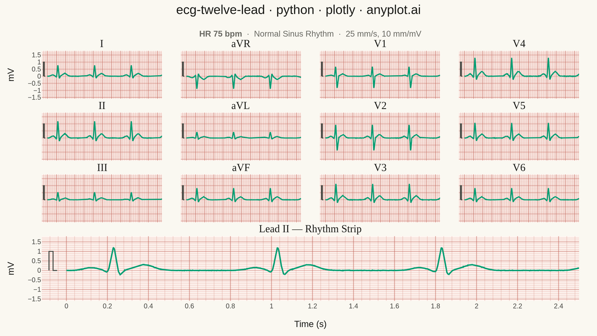 ECG/EKG 12-Lead Waveform Display rendered with Plotly