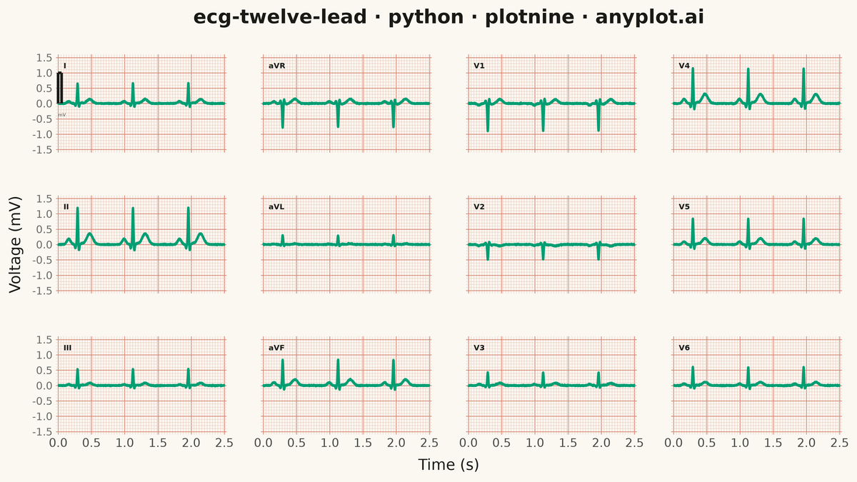 ECG/EKG 12-Lead Waveform Display rendered with plotnine