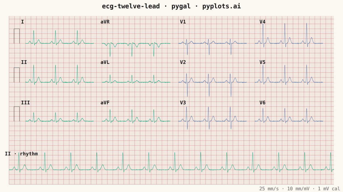 ECG/EKG 12-Lead Waveform Display rendered with Pygal