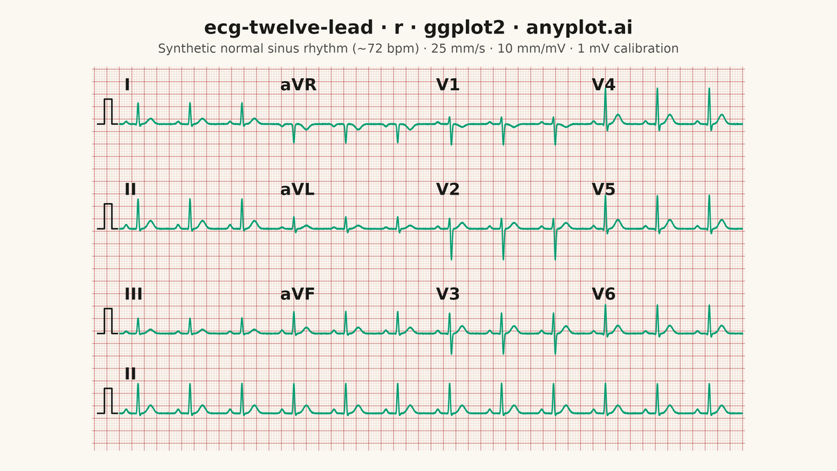 ECG/EKG 12-Lead Waveform Display rendered with ggplot2