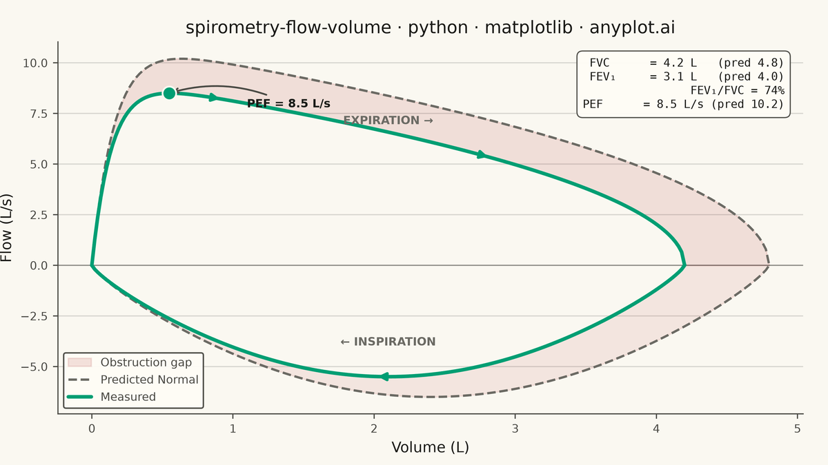 Spirometry Flow-Volume Loop rendered with Matplotlib