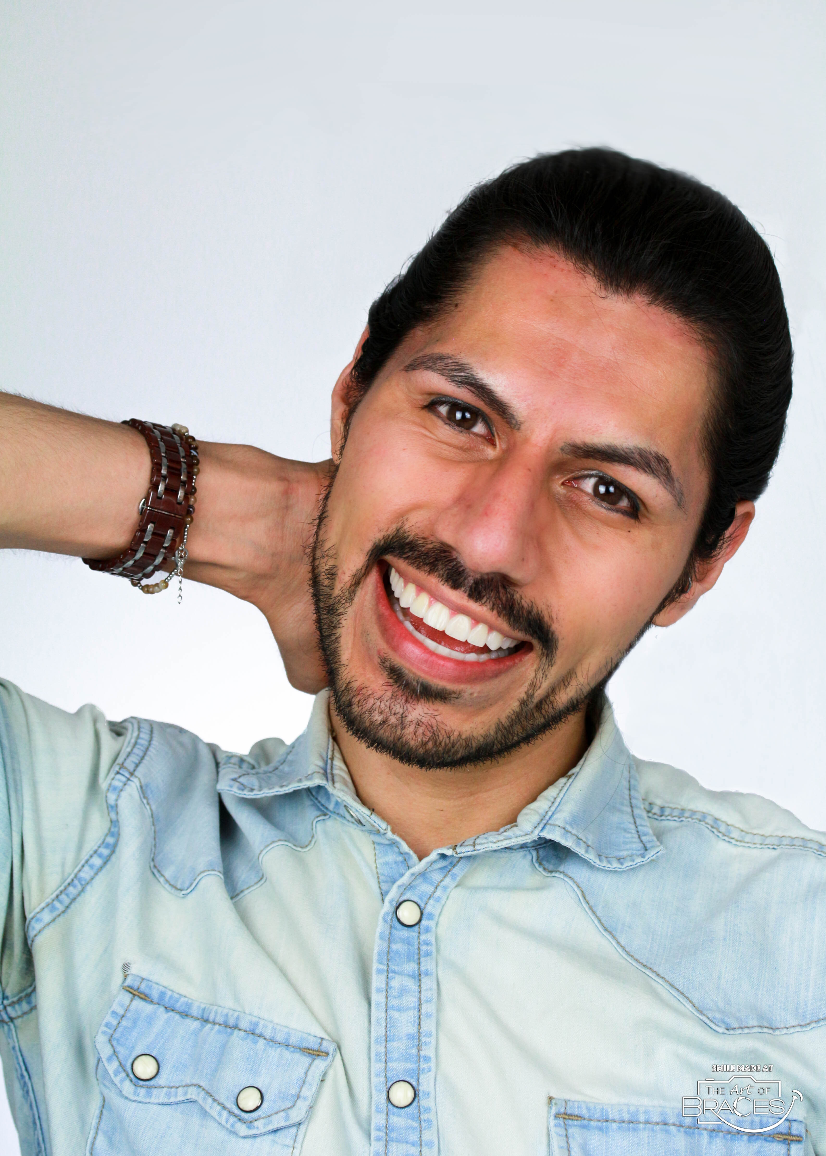 Clear Aligners vs. Metal Braces: How to Know Which Is Right for You