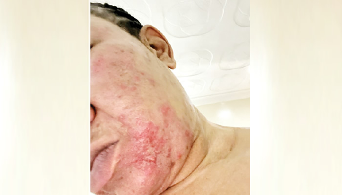 Cosmetic surgery goes wrong abuja judge therapist clash - nigeria newspapers online