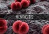 dba meningitis e
