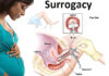 aeda surrogacy