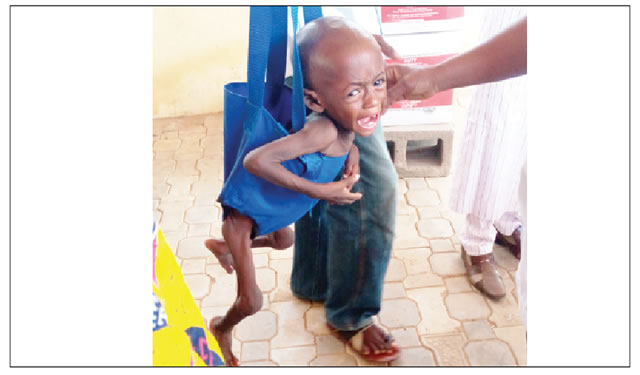 Ngo partners firm to tackle child malnutrition - nigeria newspapers online