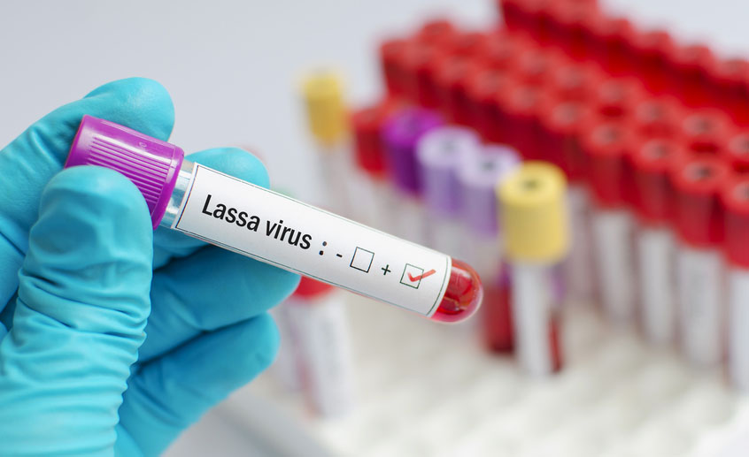 New Lassa vaccine trial puts African experts at the helm