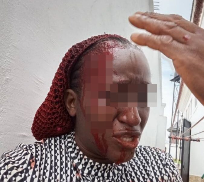 Police begin probe as husband allegedly brutalises wife in delta - nigeria newspapers online