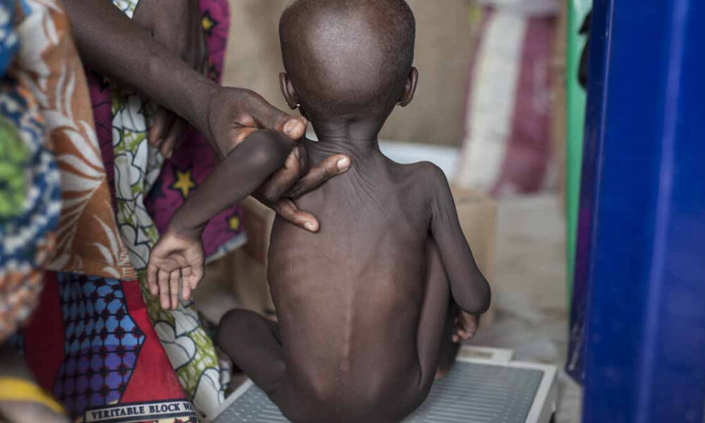 A bi-focal context to nigerias malnutrition crisis - nigeria newspapers online