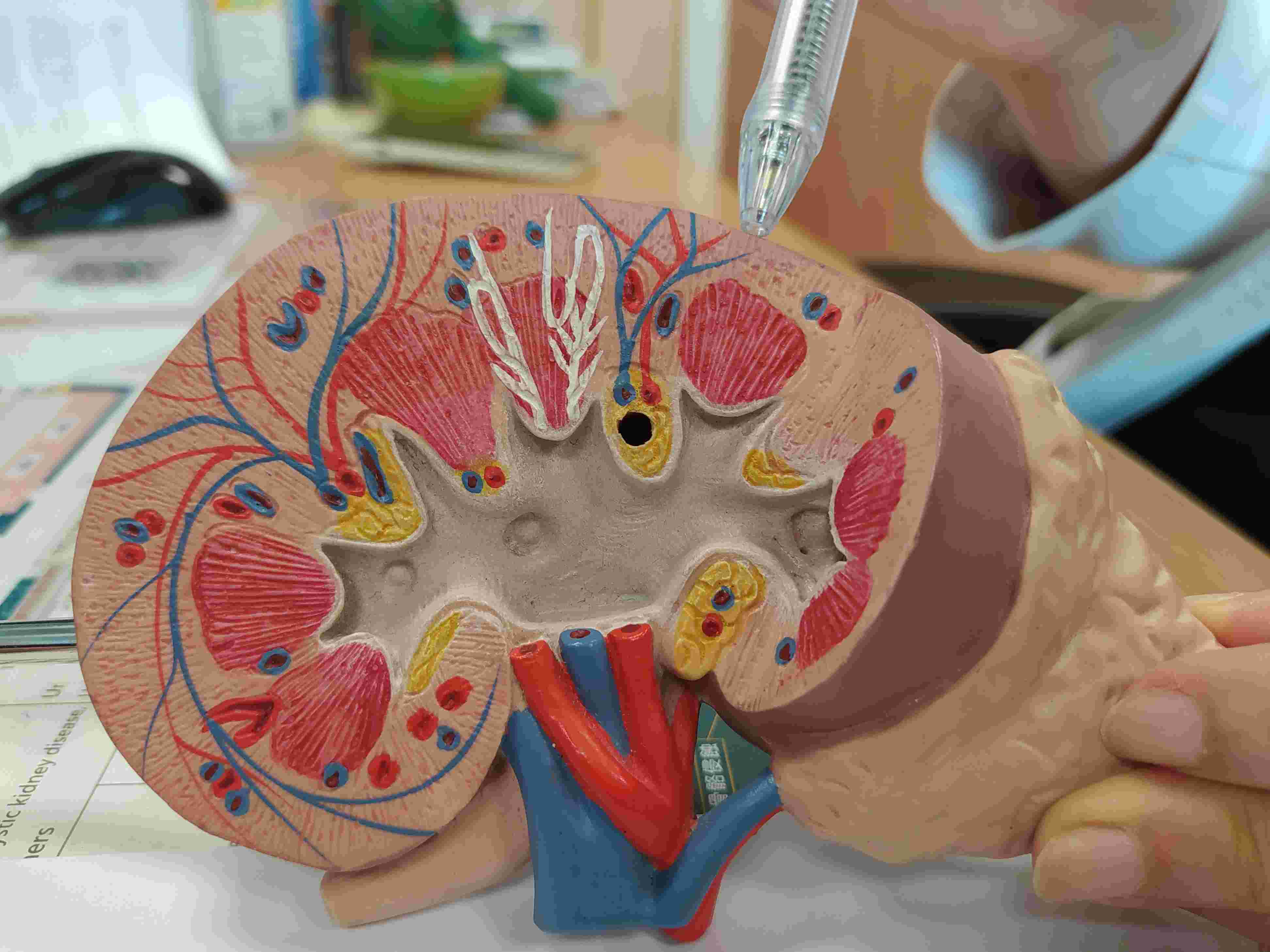 吃減肥藥與膠原蛋白 腳水腫竟是狼瘡性腎炎