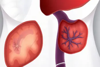 Early symptoms of cirrhosis you should know: A clinical guide to subtle warning signs