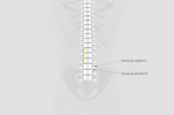 Effective ways to manage lower back pain naturally: A Clinical Overview of Conservative Care Strategies