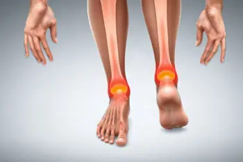 Warning signs of rheumatoid arthritis: Clinical symptom patterns and evaluation guidance