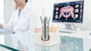 Dental implant costs in the United States versus other countries: A 2026 Comparative Report