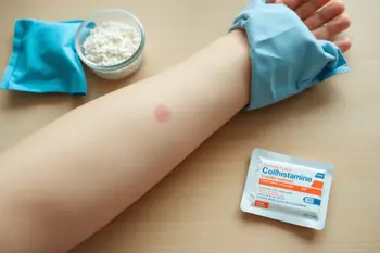 Ways to manage hives at home: A comprehensive guide to symptom relief and dermatological best practices