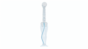 Early symptoms of sciatica you should know: A clinical overview of identifying nerve-related pain