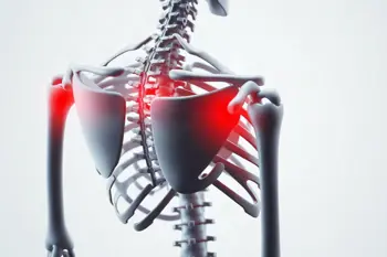 Common causes of morning stiffness: A clinical analysis of joint and muscle symptoms