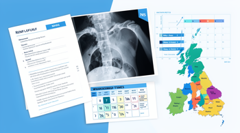 NHS Hip Replacement Referral Criteria and Waiting Times 2026: A Data-Driven Patient Guide