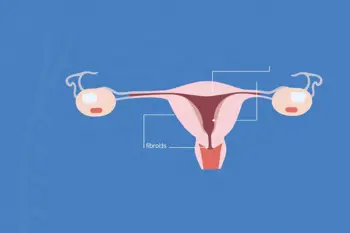 Warning signs of uterine fibroids: Clinical indicators and diagnostic considerations