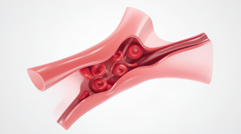 Warning signs of hypertension: Identifying the clinical indicators of elevated blood pressure
