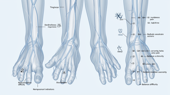 Early Indicators of Peripheral Neuropathy: A Clinical Guide to Symptoms and Warning Signs