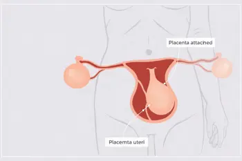 Warning signs of placental abruption: A clinical analysis of obstetric emergency indicators