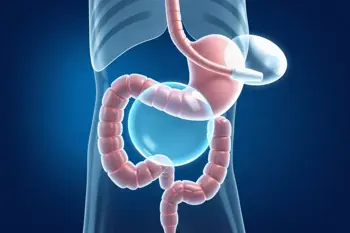 Gastric balloon procedure overview: A clinical guide to placement, eligibility, risks, and follow-up