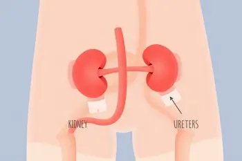 Warning signs of kidney stones: An analytical report on clinical indicators and diagnostic awareness