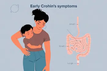 Early symptoms of Crohn's disease you should know: A clinical guide to early warning signs