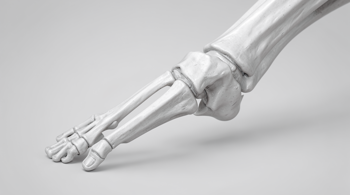 Early symptoms of gout you should know: Analyzing clinical markers and physiological progression