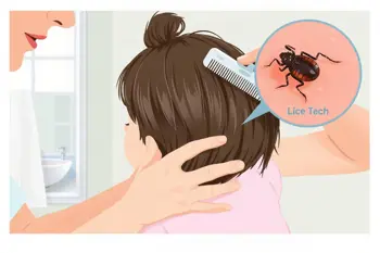 How to treat head lice infestations naturally: Evidence, safety, and follow-up guidance