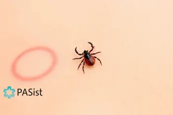 Early symptoms of Lyme disease after tick bite: A clinical review of initial manifestations