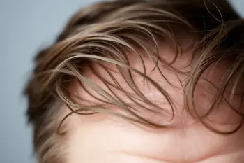 Diradamento dei capelli negli adulti sopra i 50 anni: soluzioni e gestione quotidiana: un’analisi tecnica sui meccanismi biologici e le opzioni di intervento