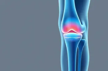 Joint stiffness after your 60s: lifestyle factors and management: Clinical Analysis of Biological Mechanisms and Evidence Based Interventions