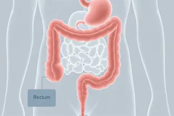 Warning signs of ulcerative colitis: Clinical indicators and diagnostic guidance