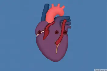 Warning signs of heart valve disease: Clinical symptoms and when they matter