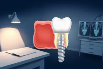 Affordable back-tooth dental implants near me: A Practical Cost and Care Guide