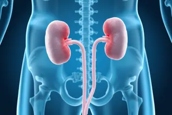 Kidney Stone Warning Signs: Analyzing Clinical Indicators and Early Symptoms for Medical Awareness