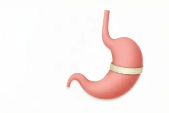 Lap-Band Surgery Results and Timeline: A Clinical Analysis of Recovery and Weight Loss Trajectories