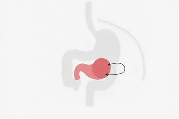 Early symptoms of chronic pancreatitis you should know: Clinical insights and diagnostic considerations