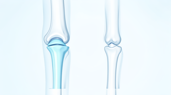 Knee replacement hospitals: 15 best options across United States: A Clinical and Operational Analysis