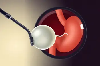 Gastric balloon results and timeline: A Clinical Analysis of Non-Surgical Weight Management