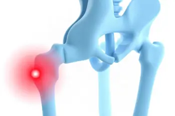 Common causes of aching hips: An analysis of clinical triggers and diagnostic patterns